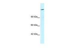 Retinoblastoma binding protein 1 Antibody, Novus Biologicals 100 &mu;L;